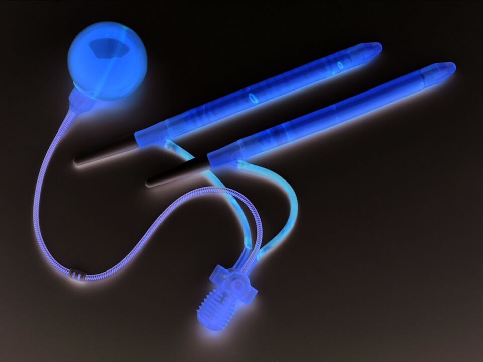 Zakila handitzeko kirurgiarako protesi artifiziala