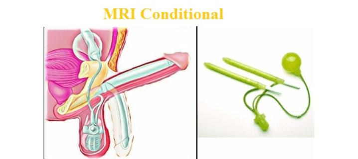 Zakilaren handitze kirurgikoa inplantea erabiliz